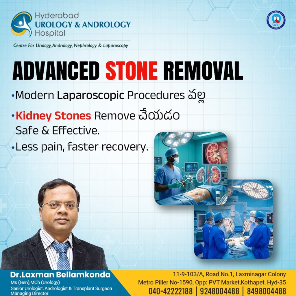 how to remove kidney stones without major surgery advanced laser treatment..#kidneystoneremova